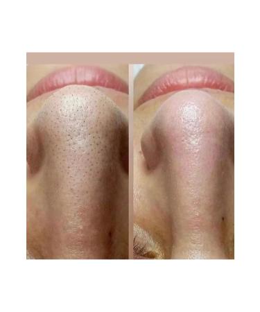 EG COSMETICS Peeling cream dermalete - Buy Online on GoSupps.com