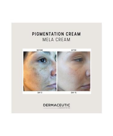 Dermaceutic MELA CREAM - 30 ML skin tone equalizer and dark spot lightening face cream - Buy Online on GoSupps.com