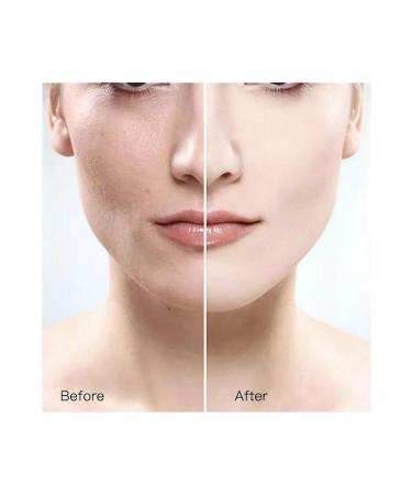 GELLO Skin Whitening Blemish Cream Whitening Whitening Cream - Buy Online on GoSupps.com