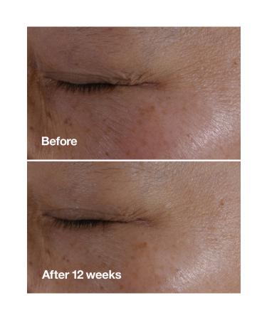 Clinique Smart Clinical Repair Anti-Wrinkle Eye Cream 15 ml 192333102749 - Buy Online on GoSupps.com