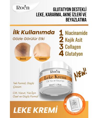 Roen Skin Whitening Blemish Cream Darkening Acne Sun Spots Glutathione Whitening Blemish Cream 50ml