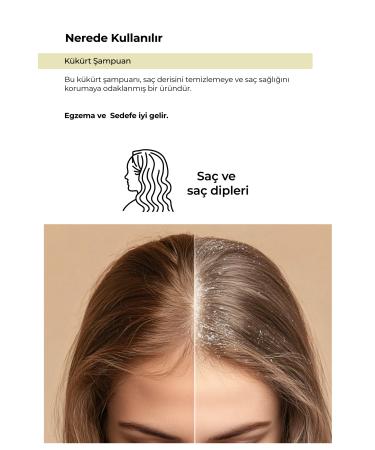 Z SHUBEAUTY Sulfur Shampoo - Buy Online on GoSupps.com