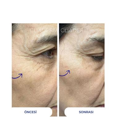 Cliaderm Instant Firming Gel Instant Firming Gel Powerful Effect in 5 Minutes - Buy Online on GoSupps.com