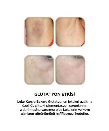 OMORFIA Skin Whitening Anti-Spot Brightening Glutathione Content Care Cream 50 ml - Buy Online on GoSupps.com