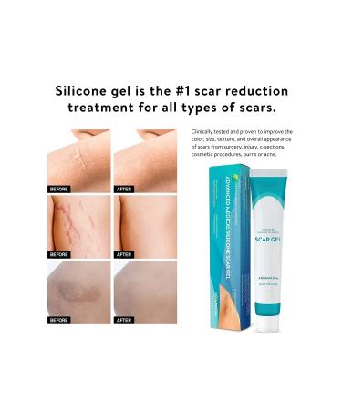 Aromamas Advanced Silicone Wound Gel - Medical Quality Gel for Keloids Surgery Burns and Injuries - Buy Online on GoSupps.com
