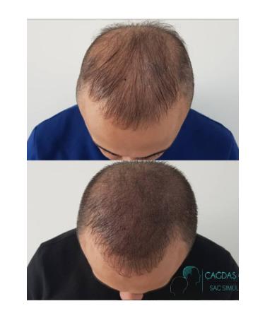 Hera Golden Ratio Dr. Scalp Hair Simulation Dye 20ml (MEDIUM BROWN) - Buy Online on GoSupps.com