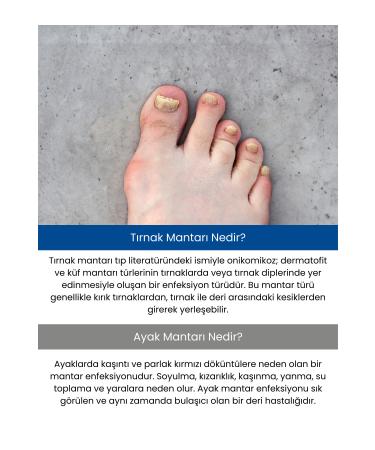 Fungalex Foot and Nail Care Spray - Buy Online on GoSupps.com