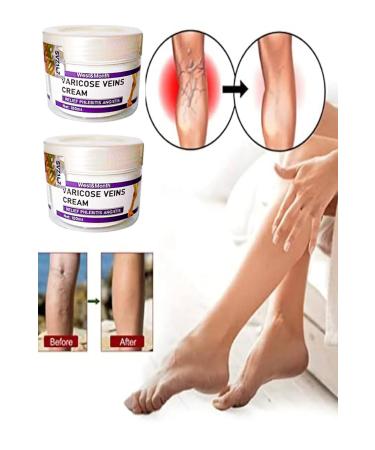 Meby Store Varicose Veins Cream West&Month Anti-Cellulite Leg Care Cream 100 ml x 2 Pieces