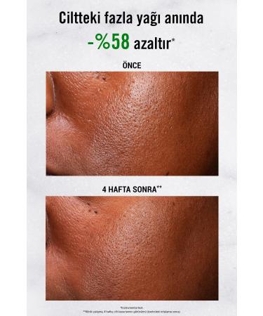 Kiehl's Brightening Serum for Brighter and More Even Skin PSSNS.154 - Buy Online on GoSupps.com