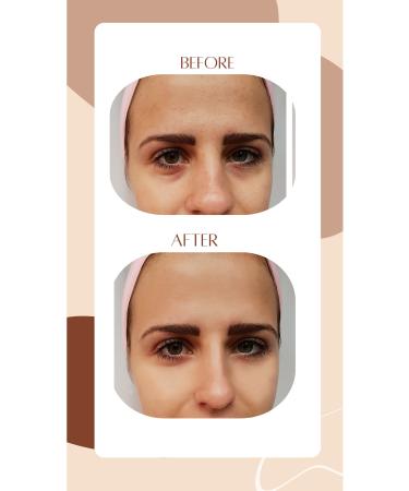 celestia glow Skin Tightening Anti-Wrinkle Botox Effective Collagen Care Serum - Buy Online on GoSupps.com