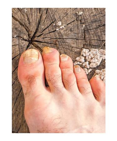 Fungalex Foot and Nail Care Spray - Buy Online on GoSupps.com