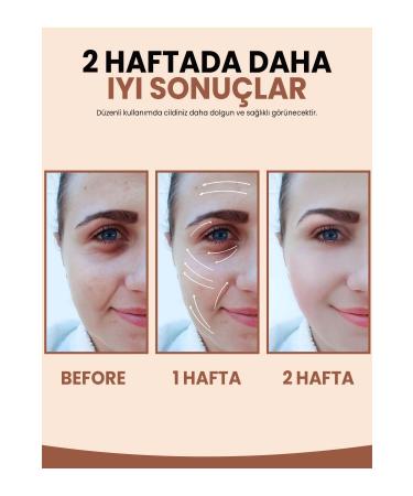 ARM Glow Vitamin C Skin Brightening and Tone Equalizing Care Serum (Niacinamide Hyaluronic Acid Panthenol) 30ml - Buy Online on GoSupps.com