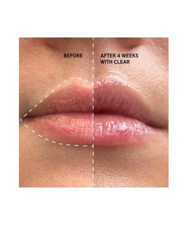 THE INKEY LIST Tripeptide Plumping Lip Balm - Plumping Lip Balm Clear (10 ml) - Buy Online on GoSupps.com
