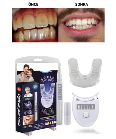 Quality Teeth Whitening Kit & Polishing Gel UV Light Dental Care Vitamin Bar Amazing Change - Buy Online on GoSupps.com