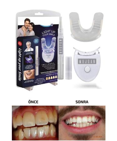 Quality Teeth Whitening Kit & Polishing Gel UV Light Dental Care Vitamin Bar Amazing Change - Buy Online on GoSupps.com