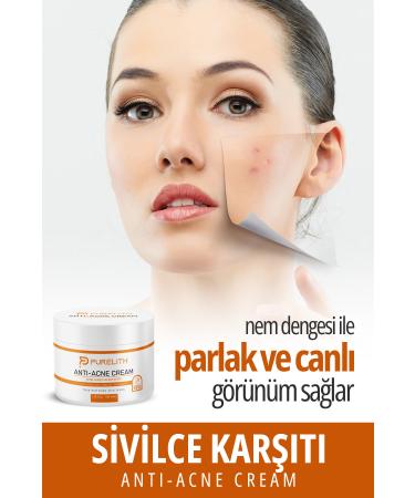 Purelith Acne and Blackhead Remover Cream 100 ml