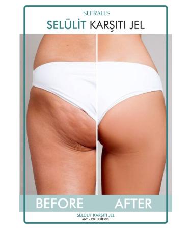 Sefralls Cellulite and Stretch Marks Remover Body Shaping Firming Gel 250 ml - Buy Online on GoSupps.com