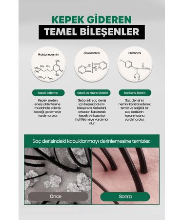 DR BANGGIWON DR. Banggiwon Clinical Dandruff Shampoo Scalp Anti Dandruff 1000 ml - Buy Online on GoSupps.com