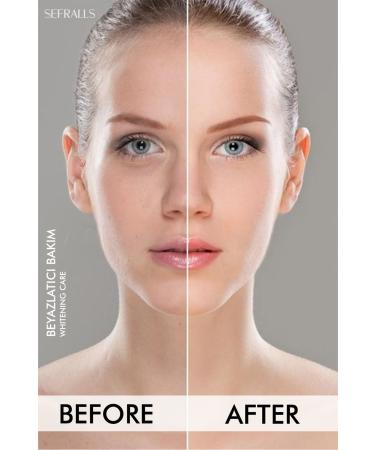 Sefralls Underarm-knee-elbow and Bikini Area Skin Whitening Cream 100 ml Skin Whitening Cream - Buy Online on GoSupps.com