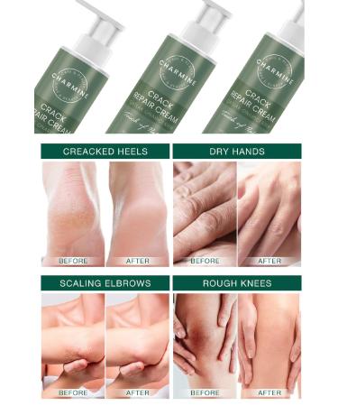CHARMINE CRACK REPAIR CREAM - Buy Online on GoSupps.com