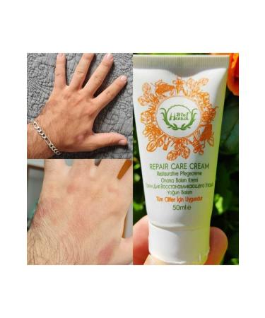 BIOHERBAL Repair Care Cream (ECZEMA DERMATITIS PSORIASIS) - Buy Online on GoSupps.com