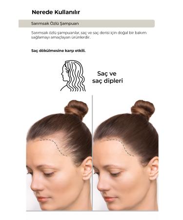 Z SHU Garlic Essence Shampoo - Against Hair Loss -400ml - Buy Online on GoSupps.com