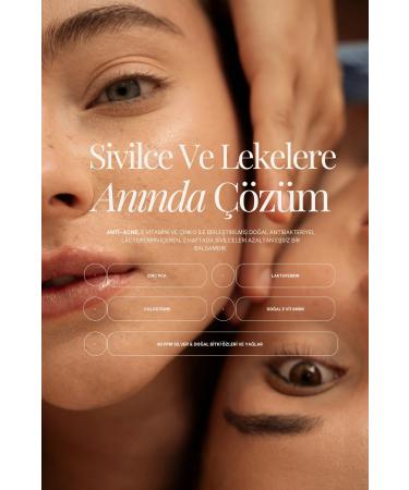 Beyond Handmade Anti-Acne Tallow Balm (ANTI-ACNE & ANTI-SPOT FACE CREAM WITH LACTOFERRIN & COLOSTRUM) - Buy Online on GoSupps.com