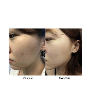 AXIS-Y Dark Spot Correcting Glow Serum 50 ml Anti-Spot Brightening Niacinamide Skin Serum - Buy Online on GoSupps.com