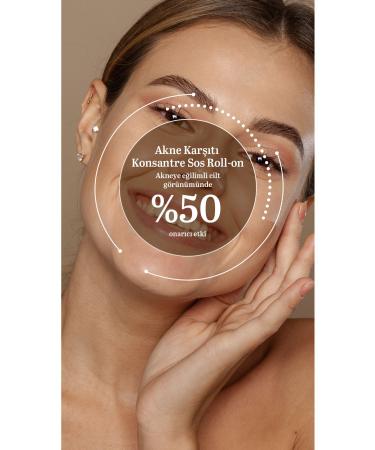 LABOTE Anti-Acne Concentrate Sauce Roll-on 10 Ml - Buy Online on GoSupps.com