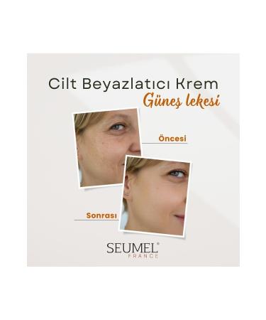 Seumel Anti-Spot Skin Whitening Cream Body Face Underarms Genital Area 200 ml - Buy Online on GoSupps.com