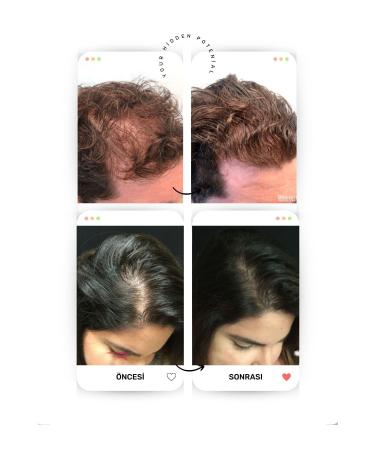 Your Hidden Potential 30 Pure Essence Hair Vitamin Serum 2 Pieces Advantageous Price - Buy Online on GoSupps.com