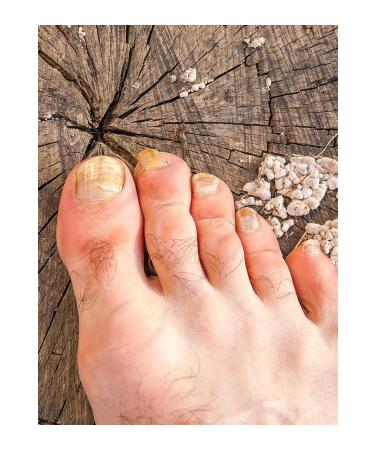 Fungalex Foot and Nail Care Spray 3 Pieces - Buy Online on GoSupps.com