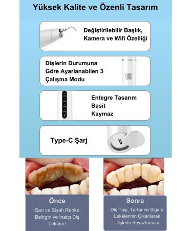 DeepSurge Camera Dental Tartar Remover Plaque and Stain Cleaner Teeth Whitening - Buy Online on GoSupps.com