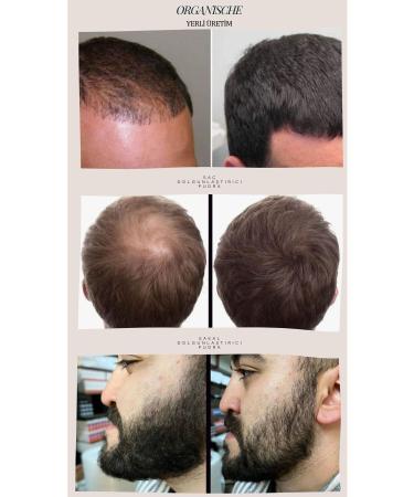 Organic Dark Brown Water-Resistant Hair Beard Thickening Topical Powder. Lasts Until First Shampooing - Buy Online on GoSupps.com