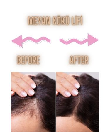 IKT Licorice Root Hydrosol Water Skin Tone Equalizer & Miraculous New Baby Hair Lasting Shine - Buy Online on GoSupps.com