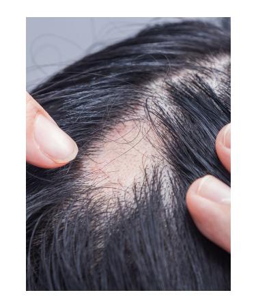 Your Hidden Potential 30 Pure Essence Hair Vitamin Serum - Buy Online on GoSupps.com