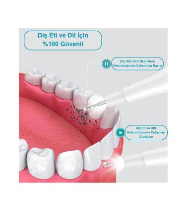 DeepSurge Camera Dental Tartar Remover Plaque and Stain Cleaner Teeth Whitening - Buy Online on GoSupps.com