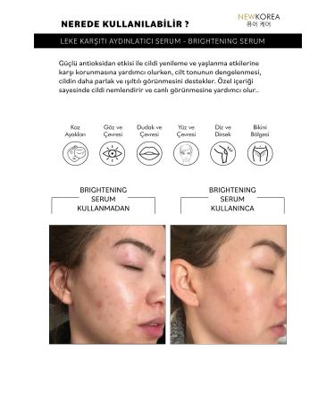 NewKorea Anti-Spot & Skin Tone Brightening Serum 30ml (Hyaluronic Acid & Vitamin C) - Buy Online on GoSupps.com