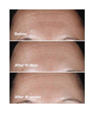 Clinique Smart Clinical Repair Anti-Wrinkle Serum 30 ml - Buy Online on GoSupps.com