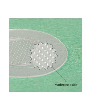 Troubless SOS CLEAR GEL CREAM+MICRO POINT PATCH 9-PIECE TEA TREE EXTRACT TAPE - Buy Online on GoSupps.com