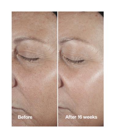 Clinique Smart Clinical Repair Anti-Wrinkle Serum 30 ml - Buy Online on GoSupps.com