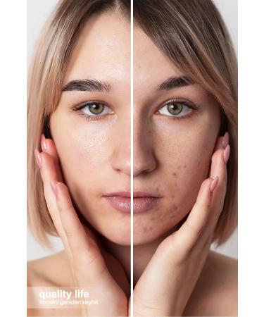 Quality Life Salicylic Acid Acne Anti-Comedone Blackhead Pore Cleanser Firming - Buy Online on GoSupps.com