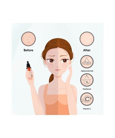 New Essentials Brightening & Skin Tone Equalizing Vitamin-C Serum (Hyaluronic Acid+ B5) - Buy Online on GoSupps.com