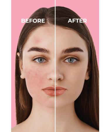 Sinoz Pink Touch Instant Tone Equalizing Pink Face Care Cream Spf50 - Mineral Sun Filter 50ml - Buy Online on GoSupps.com