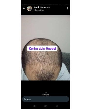 NUH Blonde Hair Solution - Buy Online on GoSupps.com