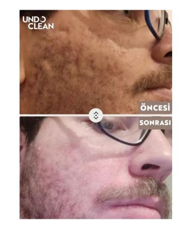 Cream Skin Whitening Cream Undo Clean Brightening Effective Result Against Stains - Buy Online on GoSupps.com