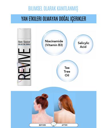 evona Revive Anti-Skin Cleansing Gel - Buy Online on GoSupps.com