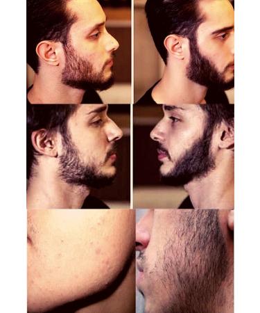 Resolvable Cosmetics Supports New Beard Formation for Sparse Beard and Beardlessness Problem Beard & Moustache Serum - Buy Online on GoSupps.com
