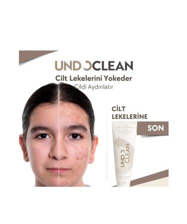 Cream Skin Whitening Cream Undo Clean Brightening Effective Result Against Stains