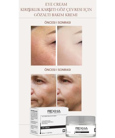 Rexha Beauty Under Eye Bags Dark Circles & Dark Circles Anti-Wrinkle Eye Contour Care Cream-20 ml - Buy Online on GoSupps.com